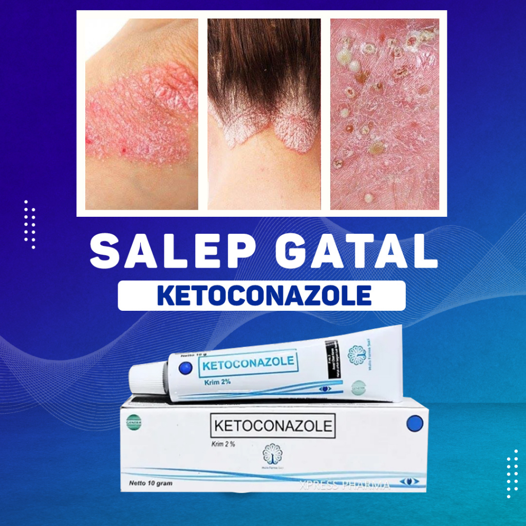 XPRESS Ketoconazole CREAM MULIA Obat Salep Jamur Gatal Panu Krim Ketoconazol Ketokonazole Ketokonazol Ketoconasole Ketoconasol Ketokonasol Ketokonasole