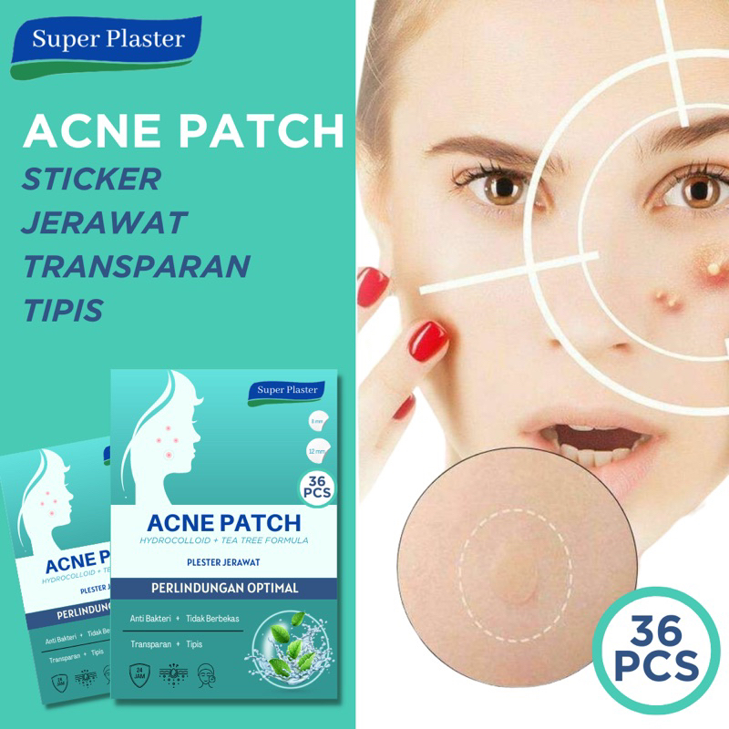 Plester Jerawat Acne Patch 36 Pcs - Penghilang Jerawat Acne Treatment With Salicycid Acid and Tea Tree Obat Jerawat