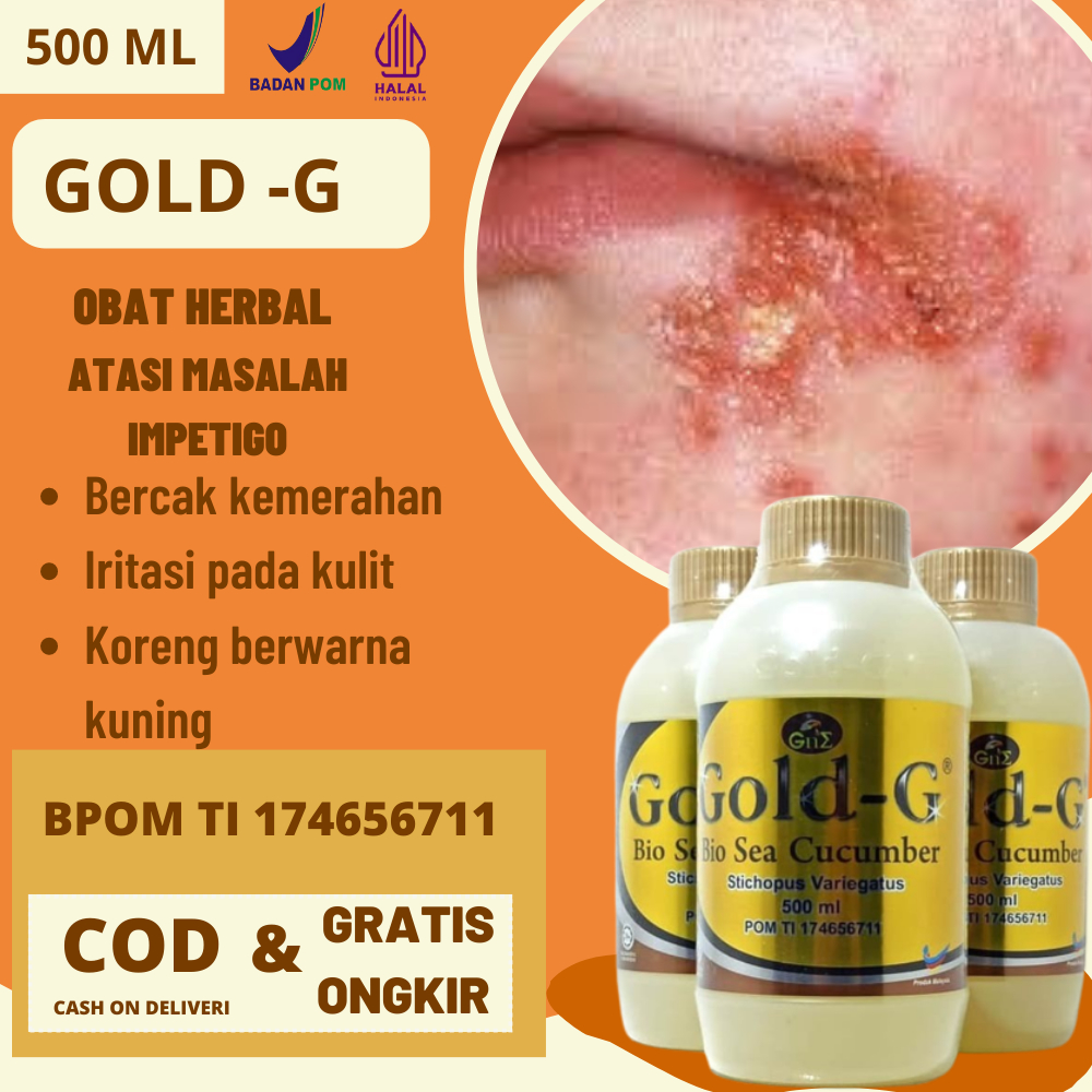 Obat Herbal Mengobati Impetigo Pada Anak Bisa Di Oles Salep Ampuh Penghilang Impetigo