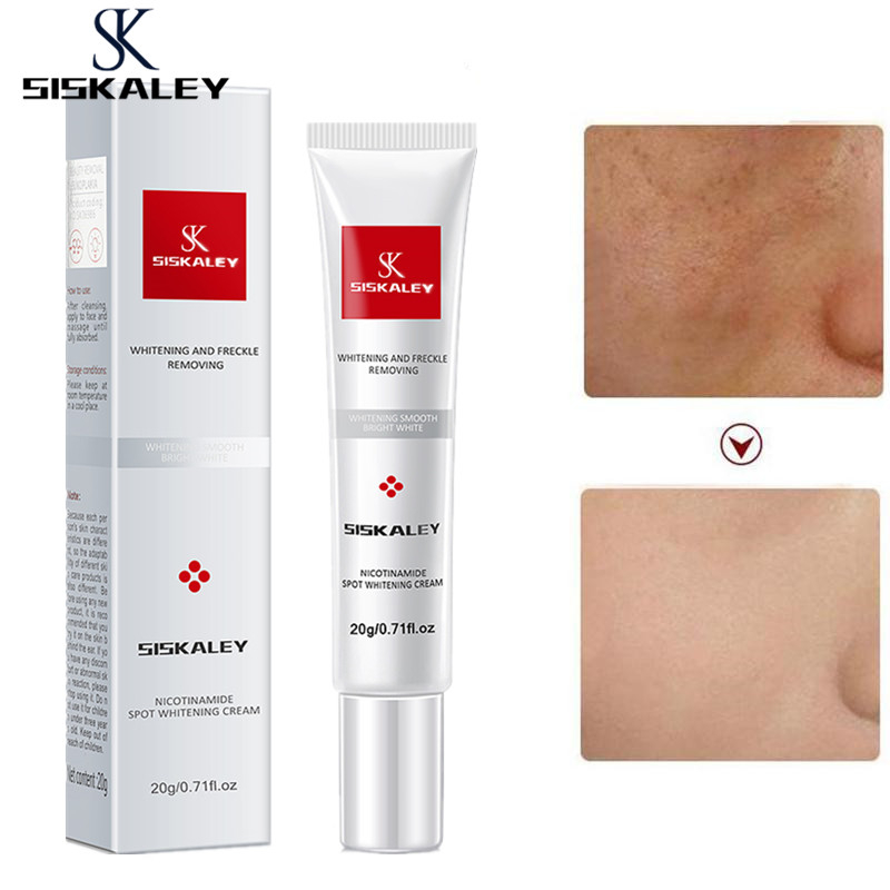 【BPOM】YOUBUY/SISKALEY 20g Whitening and Freckle Removing Cream Niacinamide Fade Pigmentation Melasma Brighten