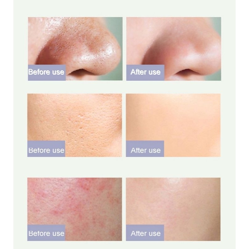 Meidian Green Tea Cooling Cleansing Mud Mask / Masker Wajah Komedo &amp; Jerawat / Meidian Masker Wajah Green Tea Clay Mask / Masker Membersihkan Komedo / Masker Meredakan Jerawat / Green Tea Mud Mask / Pore Clean Clay Mask / Masker Menghilangkan Komedo