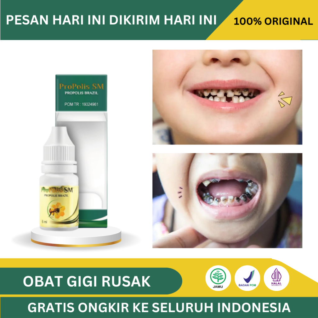 Obat Gigi Anak Hitam, Obat Gigi Keropos,Obat Gigi Berlubang, Obat Gusi Bengkak, Obat Gigi Ngilu, Oba