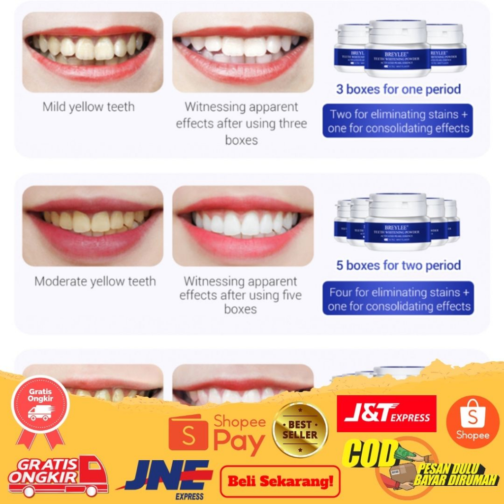 Snap On Smile BREYLE Teeth Whitening Powder Pemutih Gigi Kuning Permanen Ori Permanen TERLARIS