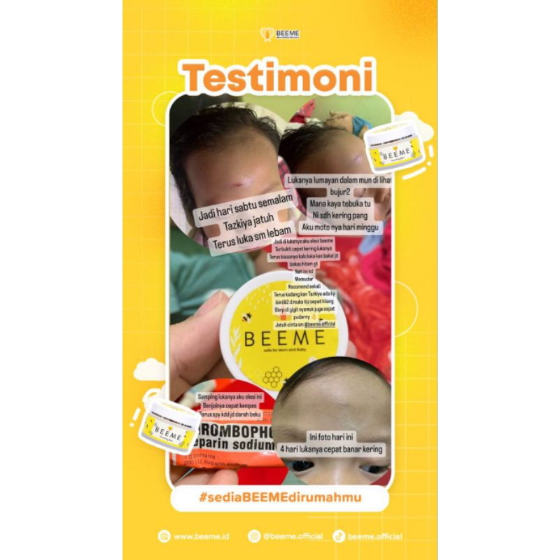 BEEME NOURISING BALM ORIGINAL || PELEMBAB SERBAGUNA