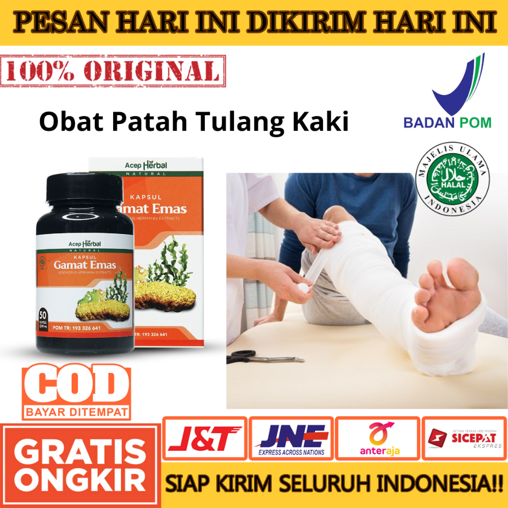 Obat Patah Tulang, Pemulihan Patah Tulang, Patah Tulang Kaki, Patah Tulang Tangan, Penyambung Patah 