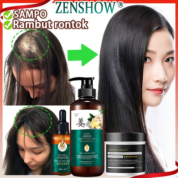 ZENSHOW Shampo Rambut Rontok dan Penumbuh Rambut Tebal 500ml Shampo Anti Ketombe Gatal Anti Rambut Rontok Formula Botani Fast Grow Shampoo 100% Original