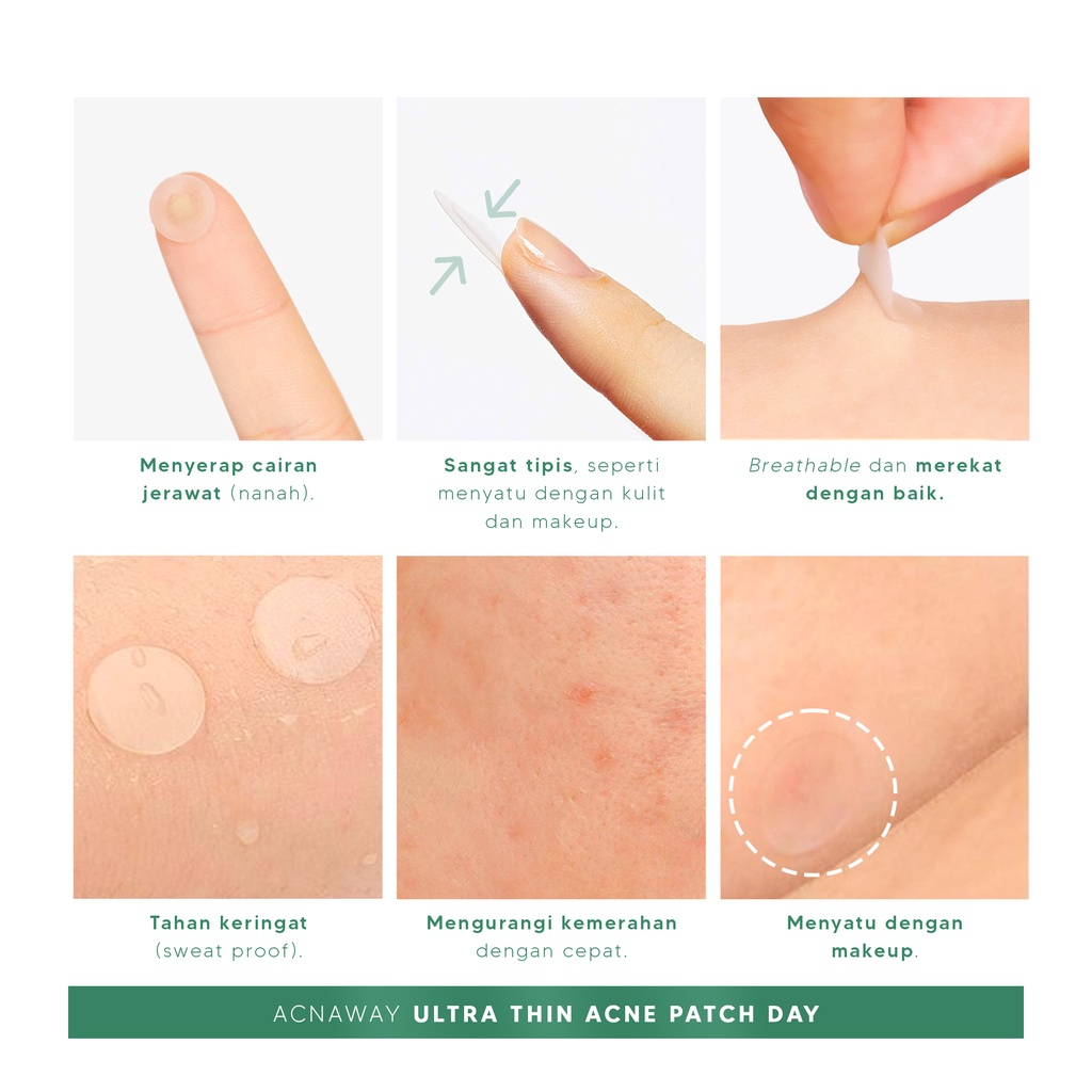 ACNAWAY Ultra Thin Acne Patch 24 pcs Acne Treatment Sticker Jerawat Super Tipis Penghilang Jerawat with Salicylic Acid Tea Tree