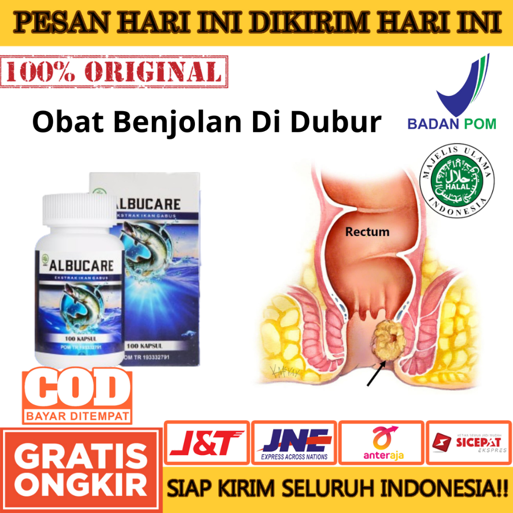 Obat Benjolan Di Dubur, Mengatasi Sembelit, Mengatasi Rasa Sakit Saat Buang Air Besar, Menguragi Ket