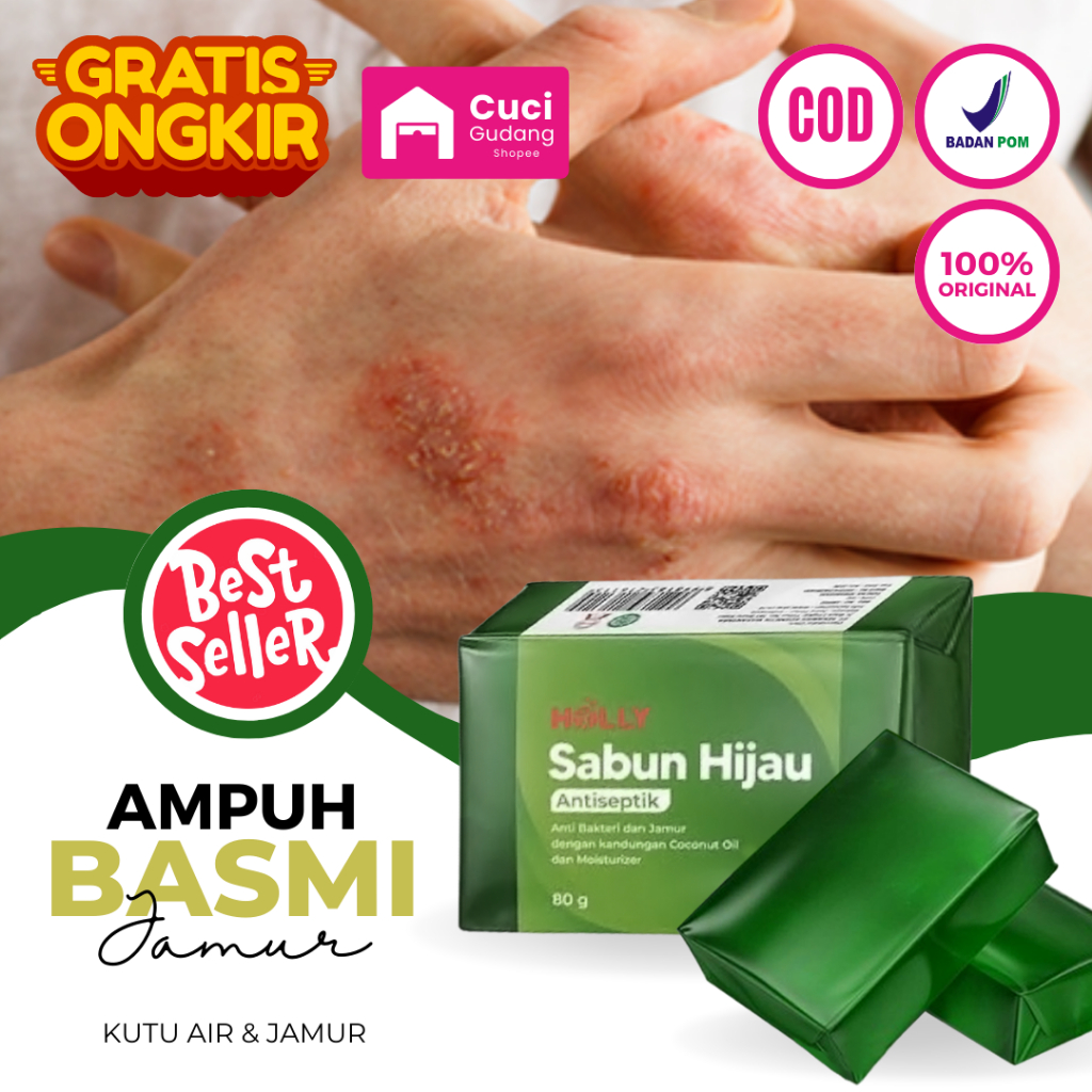 Sabun Holly Hijau Antiseptik Sabun Panu Paling Ampuh 100% Penghilang Bekas Jerawat Sabun Untuk Jeraw
