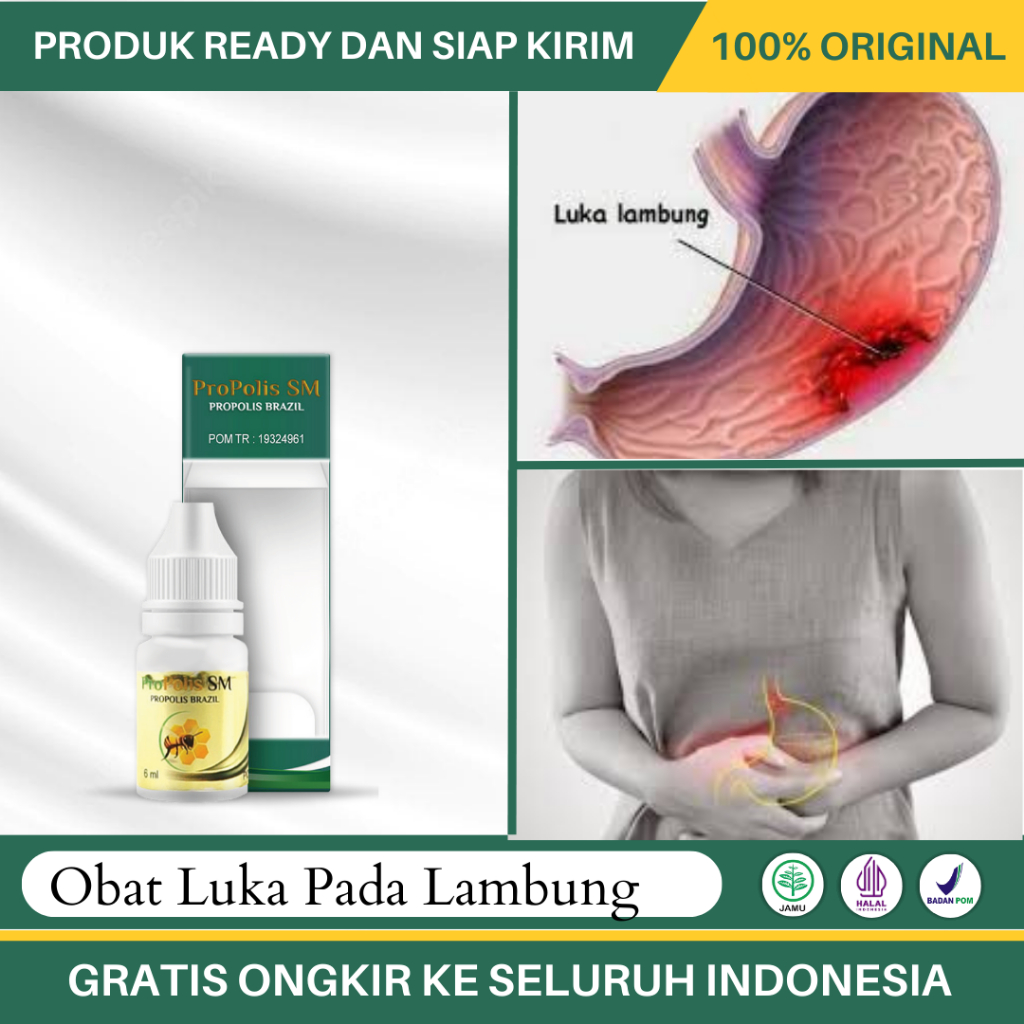 Obat Luka Lambung, Obat Lambung Luka Kronis, Obat Nyeri Pada Lambung, Obat luka Pada Usus - Propolis