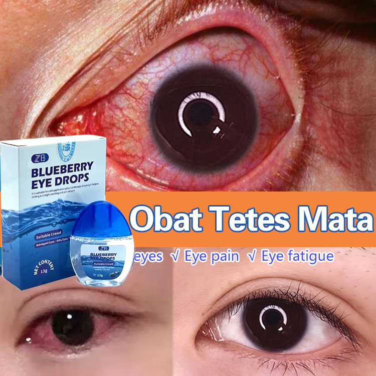 Eyecare Ampuh / Tetes Mata Herbal / Obat Tetes Mata / Obat Tetes Mata Minus / Katarak / Glucoma Obat