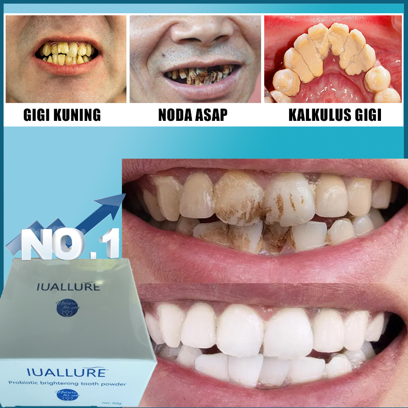 [Kuat]IUALLURE Teeth Whitening Powder 50g Travel Essential Probiotik Pemutih Gigi pembersih karang g