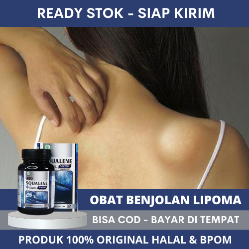 Obat Lipoma, Penghancur Benjolan Lipoma, Tumor Lipoma, Penghancur Lipoma, Pengempis Lipoma, Penghila