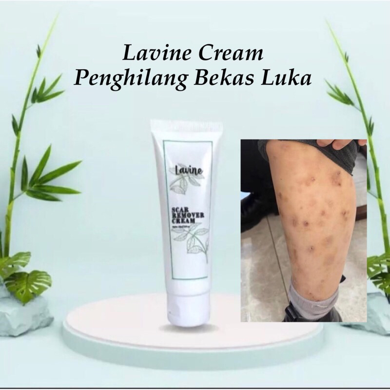LAVINE SCAR REMOVER CREAM PENGHILANG BEKAS LUKA PALING AMPUH