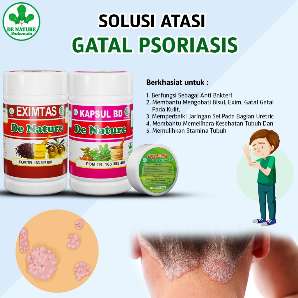 Obat Gatal Psoriasis Kulit Kepala berkerak dan bersisik Kering Bernanah berjamur Mengelupas Koreng K