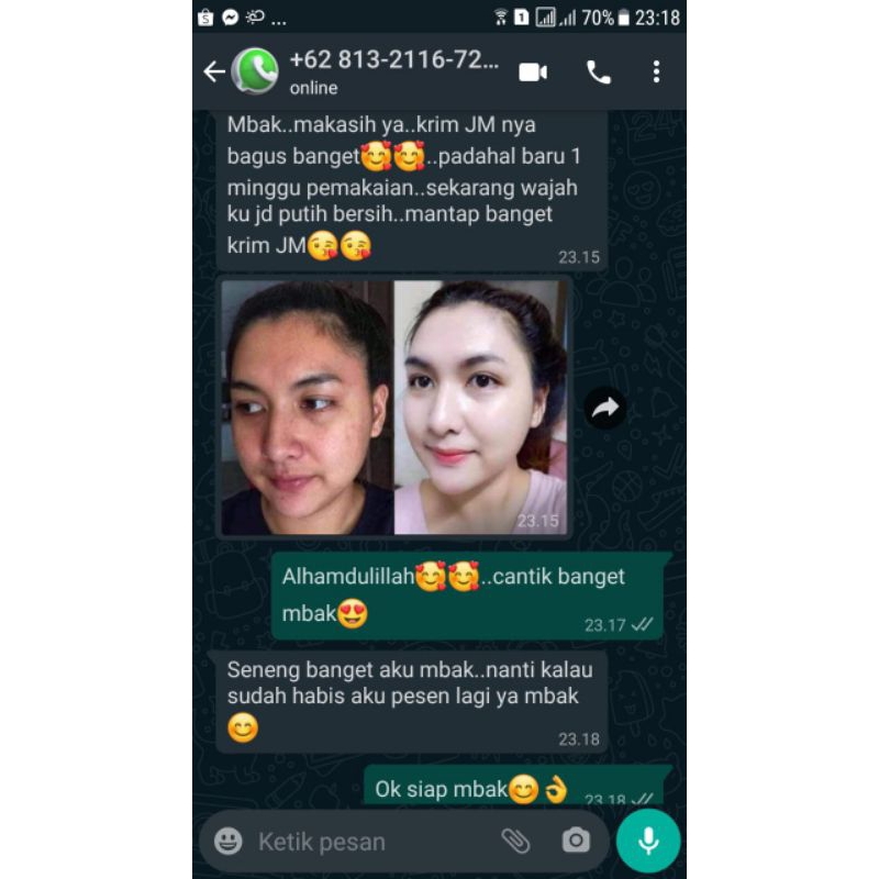 Krim Pemutih JM BPOM (1 paket)