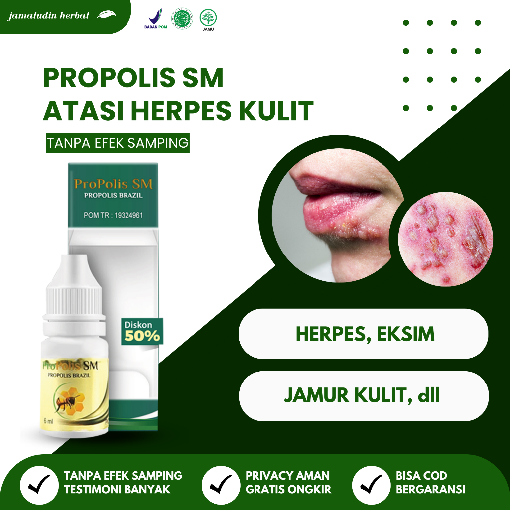 Propolis SM - Obat Herpes Zoster Kulit Bibir Genital Kelamin - Salep Penghilang Herpes Bayi Anak dan