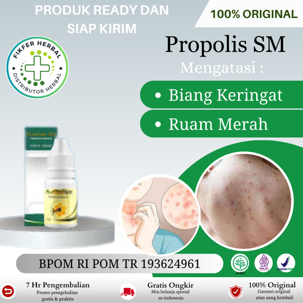 Obat Biang Keringat, Obat Penghilang Biang Keringat, Biang Keringat Di Punggung, Di Wajah, Di leher,