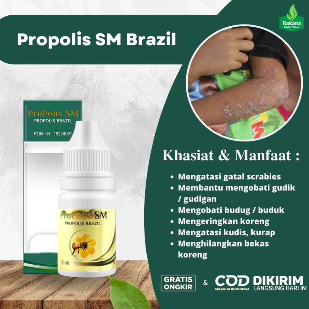 Obat Oles Scabies Pada Manusia, Obat Gatal Scabies, Obat Scabies Di Kulit, Obat Gudik, Obat Gudig, O