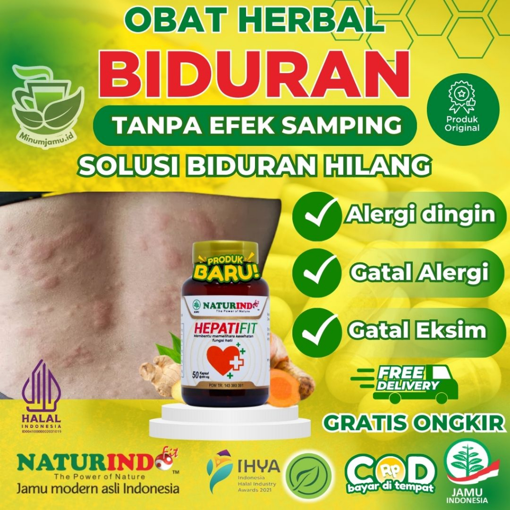 Obat Biduran Alergi, Obat Biduran, Obat Biduran Alergi Ampuh, Obat Biduran Alergi Ampuh, Obat Bidura