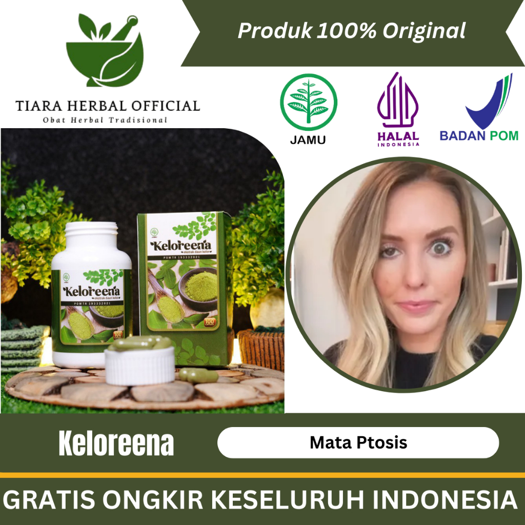 Obat Kelopak Mata Turun Sebelah, Obat Mata Ptosis, Obat Mata Beda Sebelah, Obat Mata Merem Sebelah, 