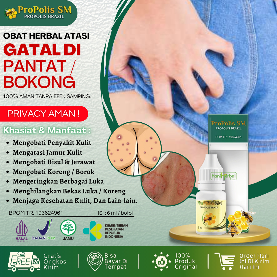 Obat Herbal Untuk Atasi Gatal Pantat / Bokong - Obat Pantat Bruntusan / Pantat Burik / Penghilang Be