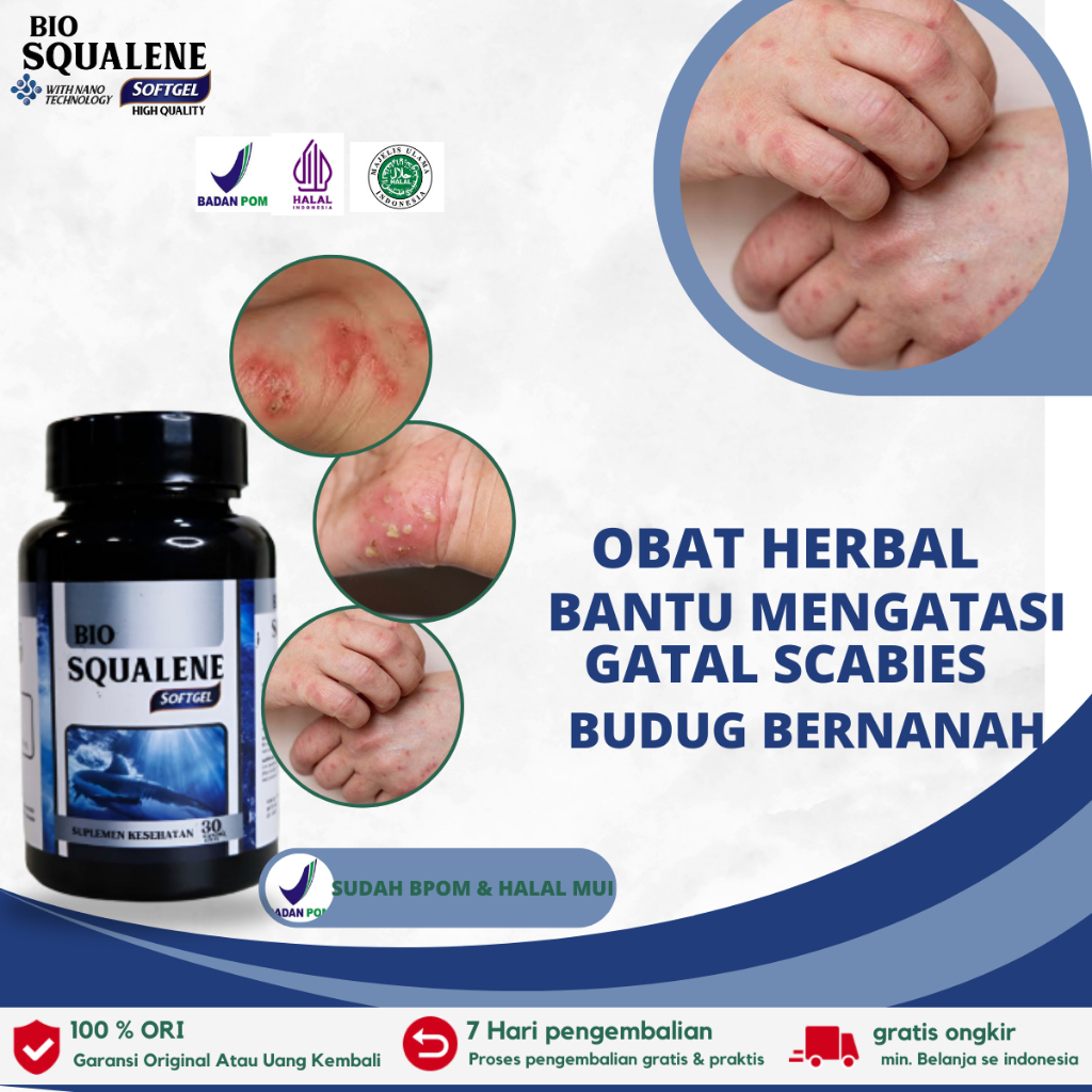 Obat Gatal Scabies , Budug Bernanah , Penghilang Koreng , Borok , Gudik , Kudis , Luka Bernanah - Bi