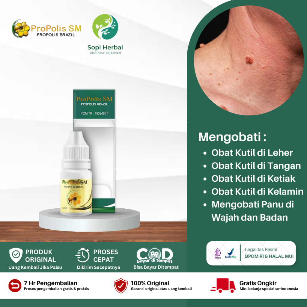 Obat Oles Penghilang Kutil, Obat Perontok Kutil Di Leher, di Tangan, di Ketiak, Obat Oles Penghilang