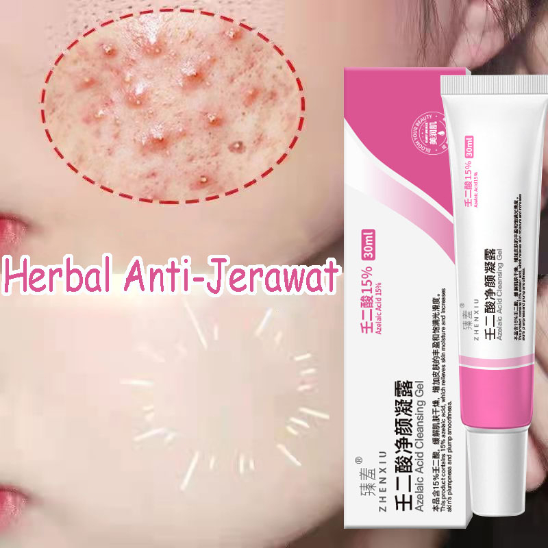 Acne Cream Krim Jerawat Azelaic Acid Cleansing Gel 30ml  Jerawat untuk Menyembuhkan dan Mengempeskan Jerawat | Acne Spot | Night Day Cream | Essence | Skincare Skin