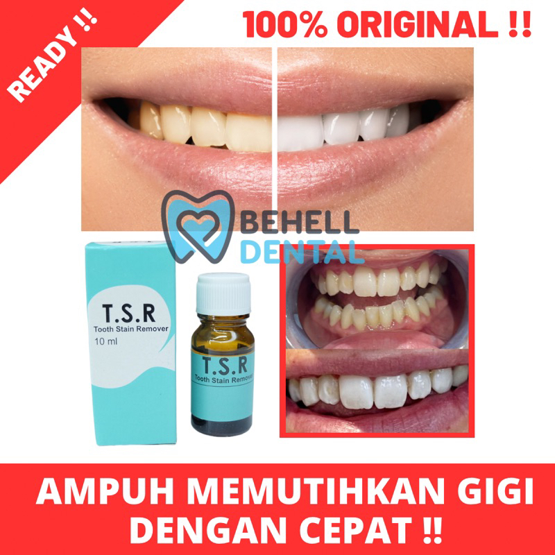 CAIRAN AMPUH PEMUTIH GIGI TSR TOOTH STAIN REMOVER - PENGHILANG PEMBERSIH PELUNAK PLAK KARANG GIGI CEPAT - Penghilang Bau Mulut