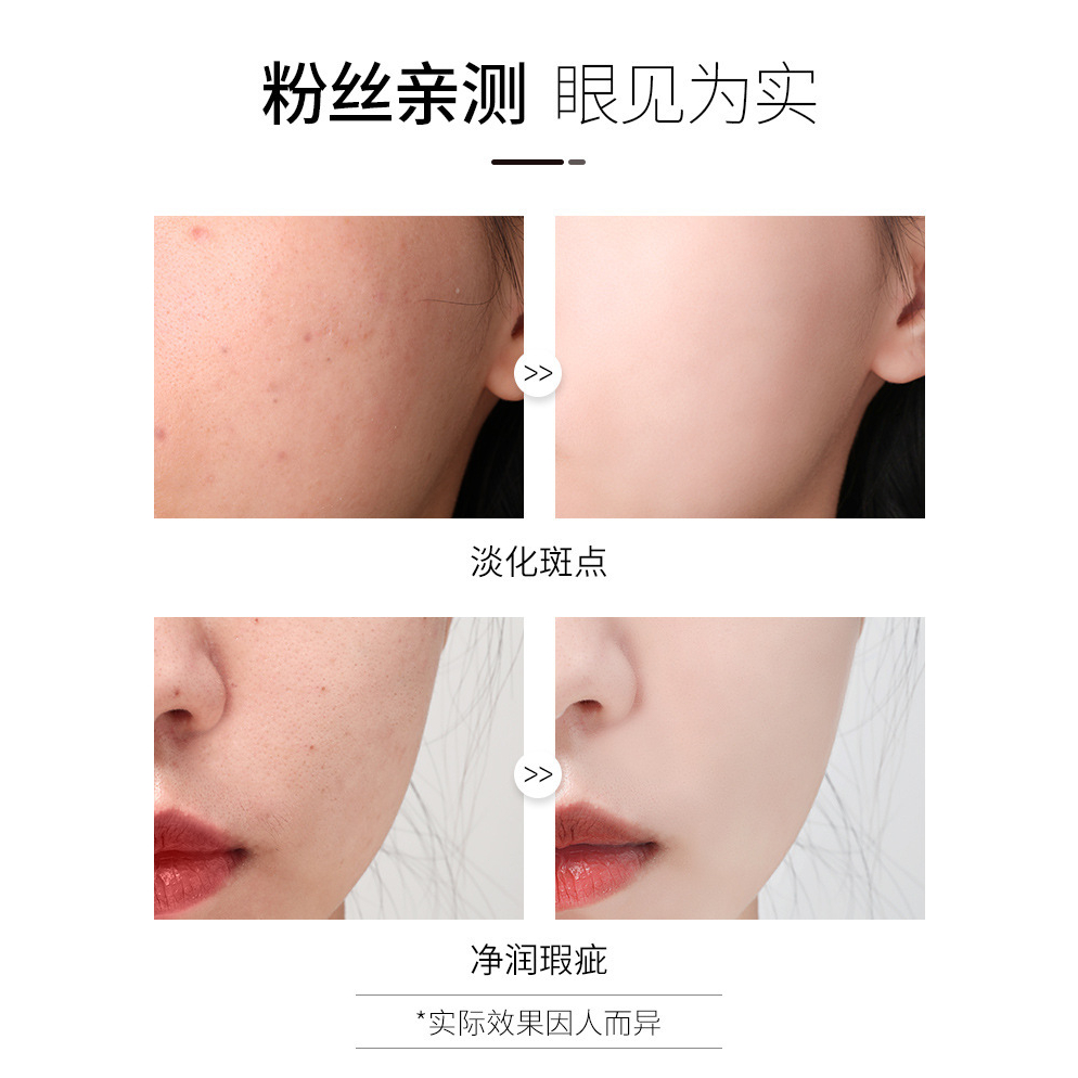 Dark Spot Serum Brightening Serum Anti Freckle Cream Krim Penghilang flek 100ml ORI HALAL CREAM DOKTER PEMUTIH Remove Penghilang Flek/Bintik Noda Hitam Komedo