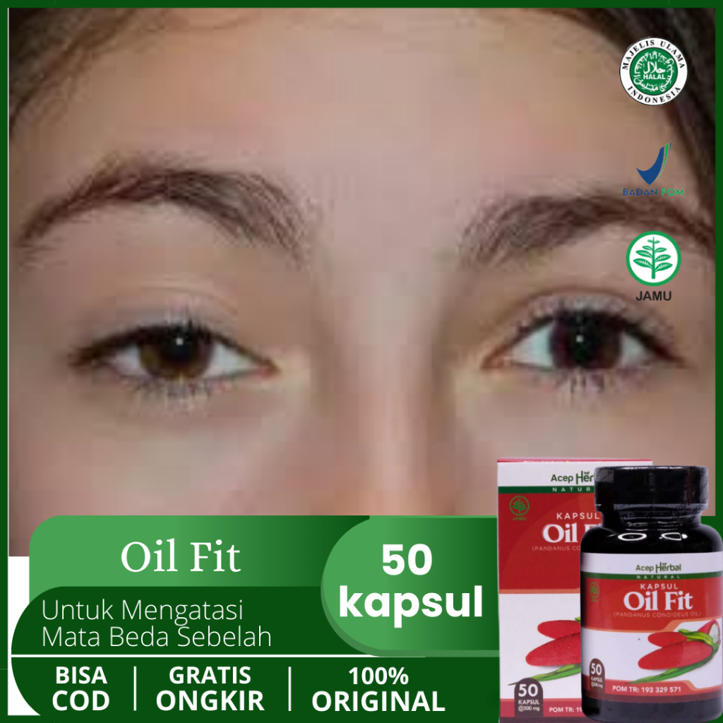 Obat Mata Beda Sebelah, Sipit Sebelah, Kelopak Mata Turun, Ptosis, Mata Kecil Sebelah, Mata Besar Se