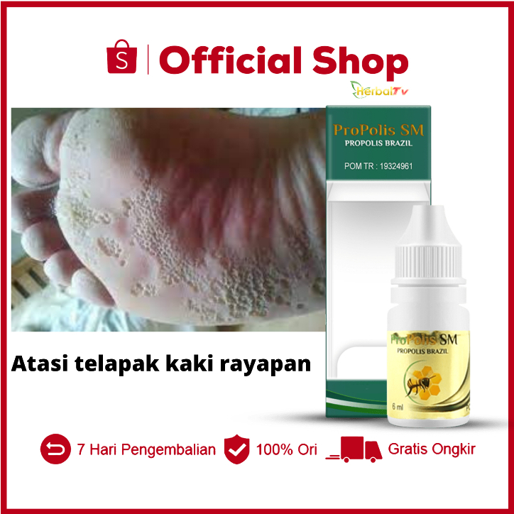 Obat kaki rayapan, telapak kaki rayapan-propolis sm Brazil 100% brazillian Ampuh original