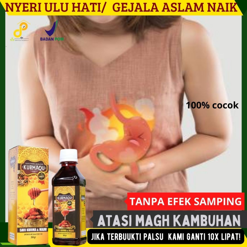 [SIAP COD] Asam lambung naik kambuh setelah buka puasa/sahur MAdu kurmawu  meredakan perut keras dan