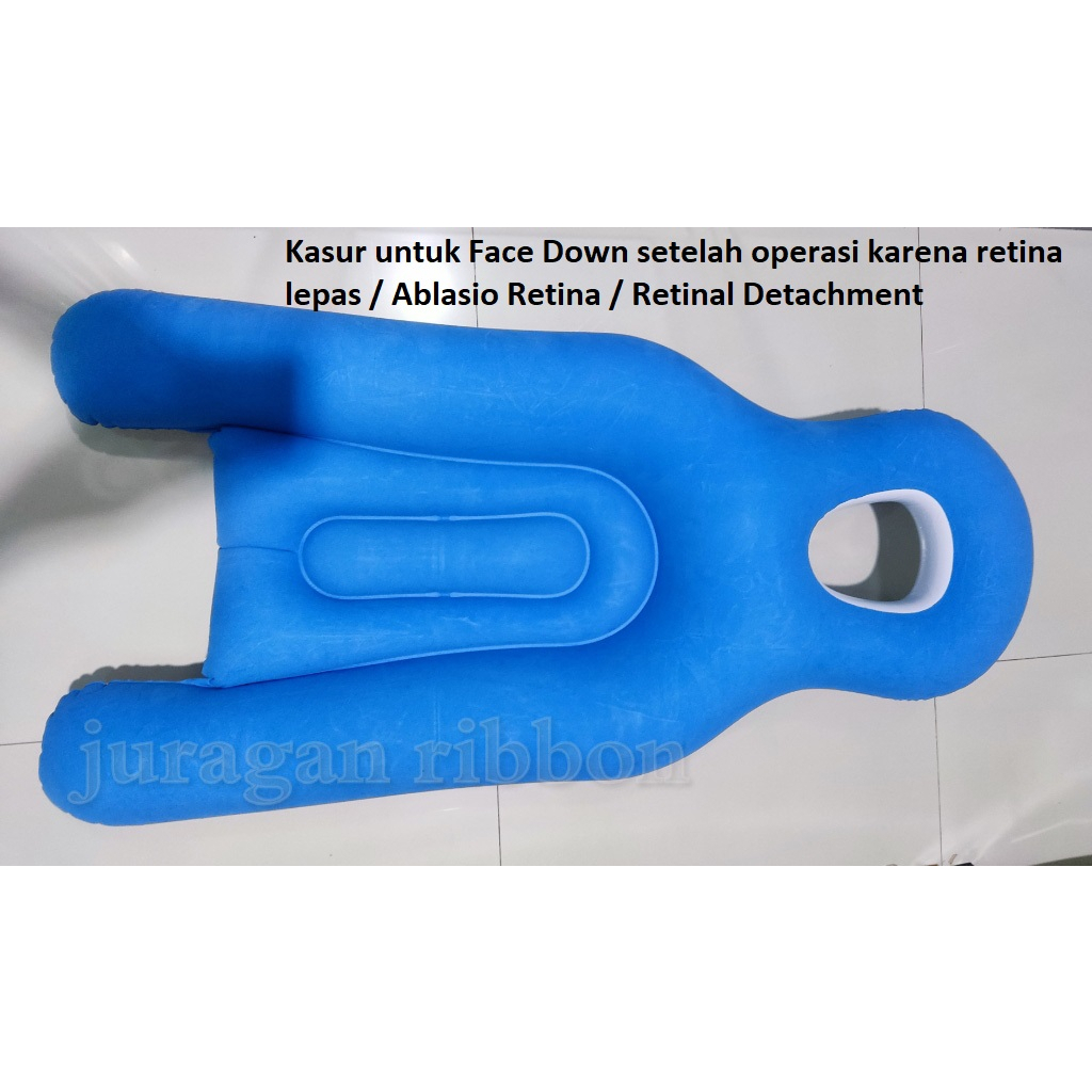 Ablasio retina / Retinal Detachment kasur untuk face down pillow