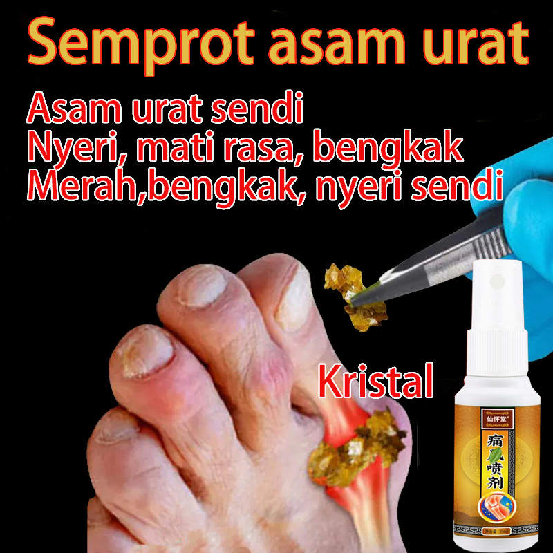 Obat Asam urat Rematik Radang Sendi Herbal 30ml Semprotan Rematik Pereda Nyeri Pada Sendi Pereda Nyeri Bunion Pengobatan Yang Efektif REMATIK ASAM URAT NYERI OTOT