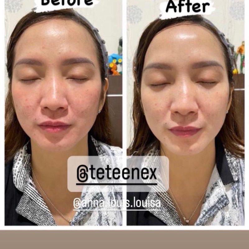BB GLOW BEAUTY MASK TE TEEN EX + 10ml Le aQua Shine water