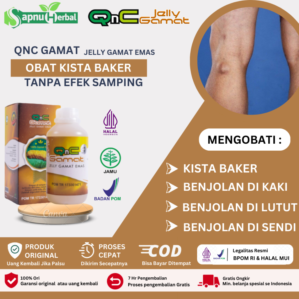 Sapnu Herbal - Obat Penghancur Kista Baker, Obat Kista Baker, Obat Alami Kista Baker, Obat Benjolan 