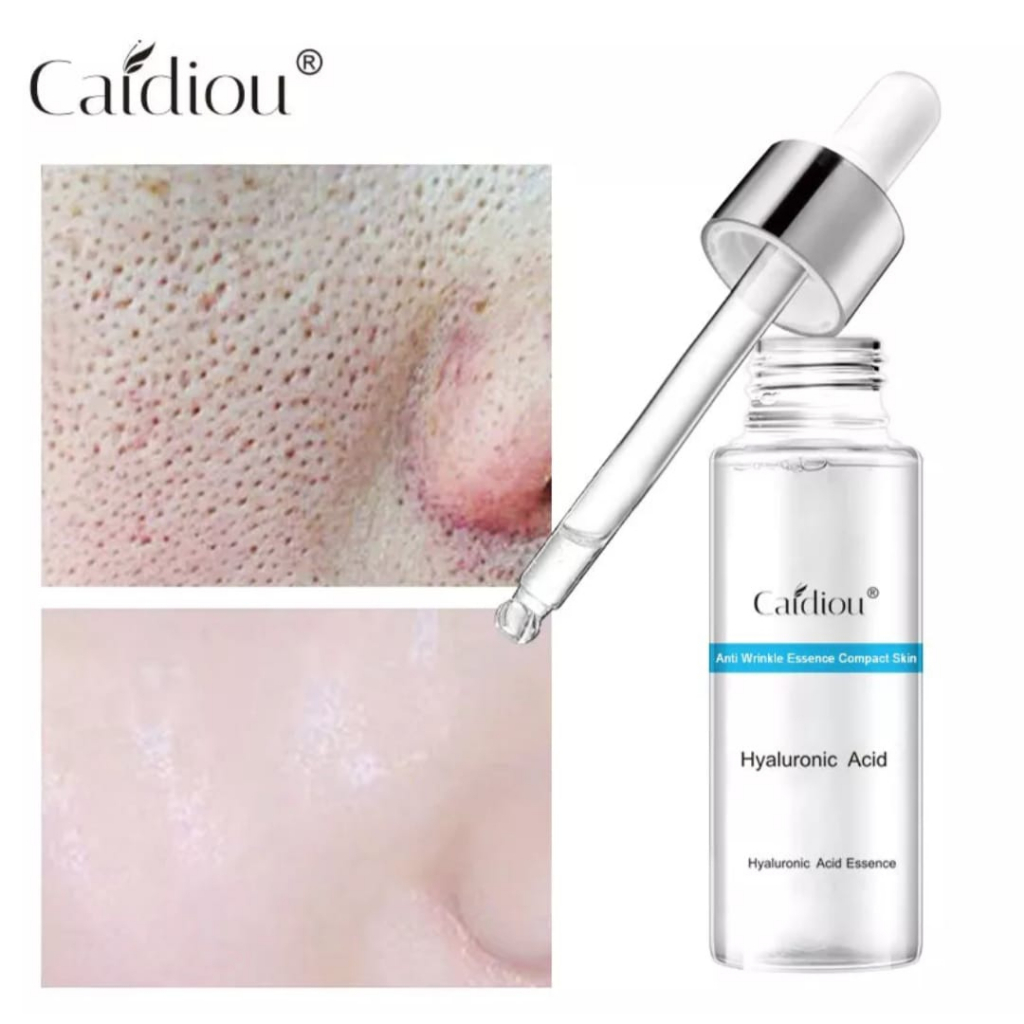 CAIDIOU SERUM PENGECIL PORI-PORI SERUM GLOWING PEMUTIH/SERUM HYALURONIC PORE ESSENCE