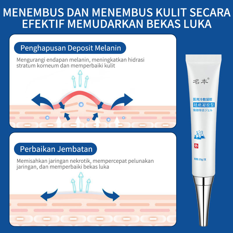 Gel menghilangkan bekas luka krim memudarkan bekas luka memperbaiki jerawat bekas luka lama bekas luka stretch mark bekas luka bakar 20g