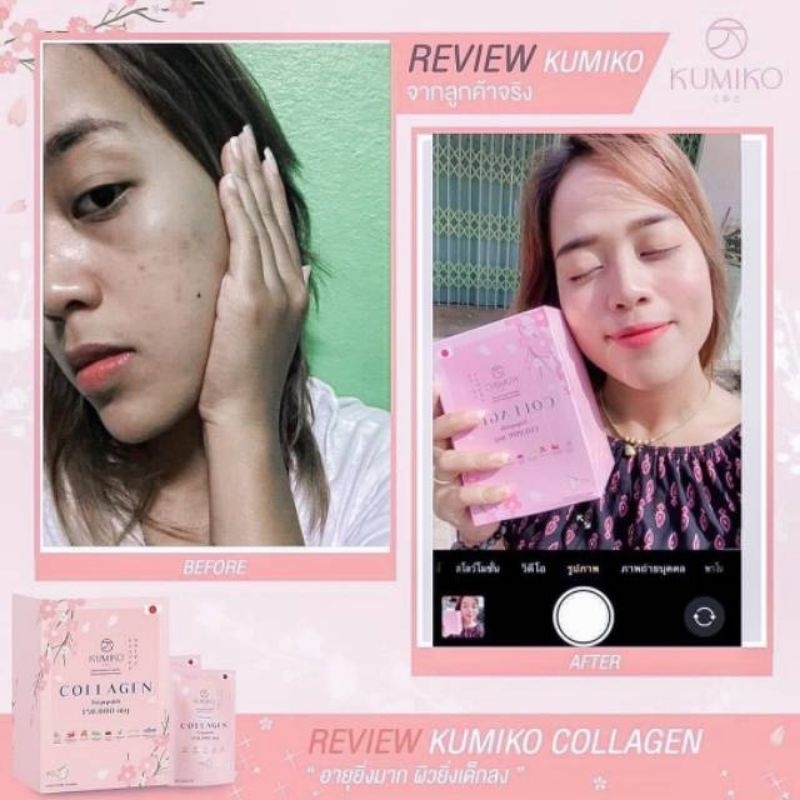 KUMIKO COLLAGEN TRIPEPTIDE 150.000 mg per 1 bungkus