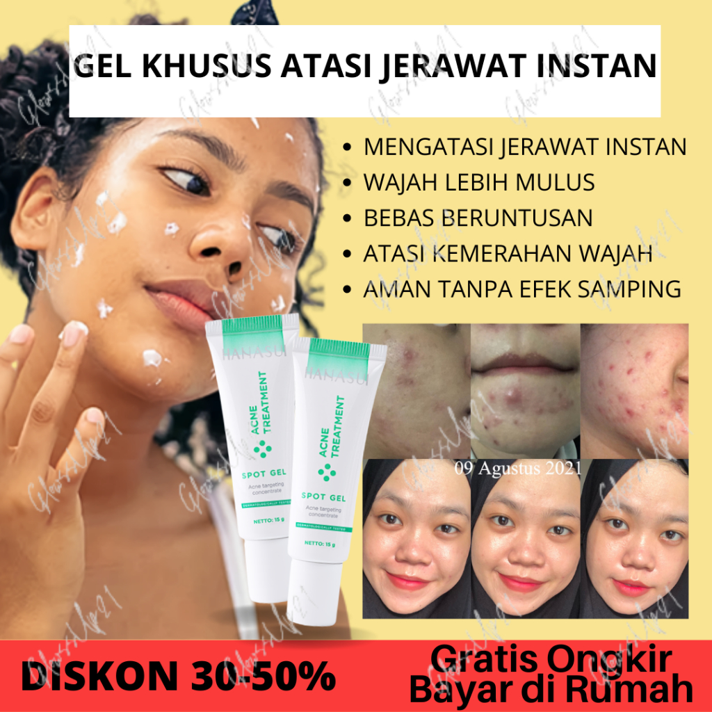 HANASUI ACNE TREATMENT SPOT GEL 15GR - SPOT GEL ACNE TREATMENT HANASUI