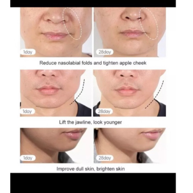 alat pengencang wajah