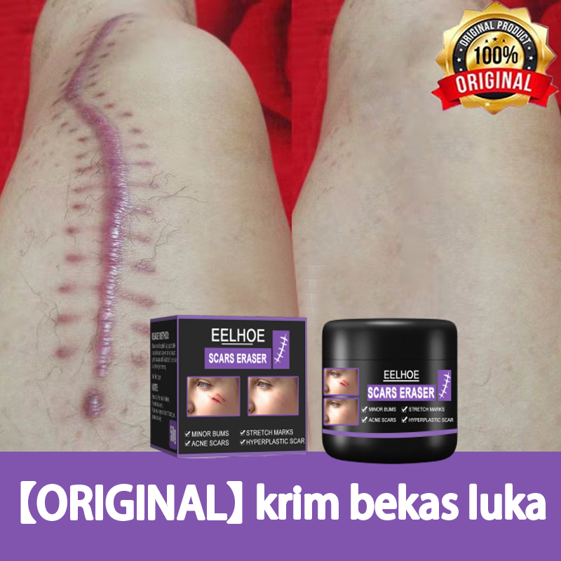 【ORIGINAL】salep bekas luka Penghilang bekas luka obat penghilang bekas luka  50g dermatix penghilang bekas luka Memulihkan Memotong Membakar Lepuh Bekas Luka Bedah dan Luka