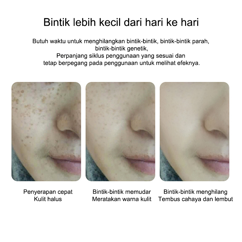 krim pemutih Bintik Cream penghilang flek hitam Krim Pemutih wajah 30g penghilang flek hitam di wajah Efektif Menghilangkan Bintik Melanin Dan Perawatan