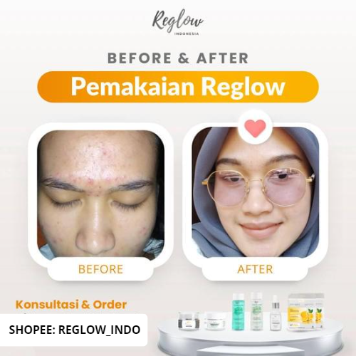 PROMO PAYDAY Reglow Paket Lengkap + Serum dr Shindy Skincare Best Combo