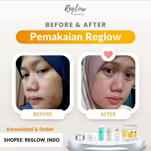 PROMO PAYDAY Reglow Night Cream + Facial Wash Skincare Dokter Shindy Best Combo