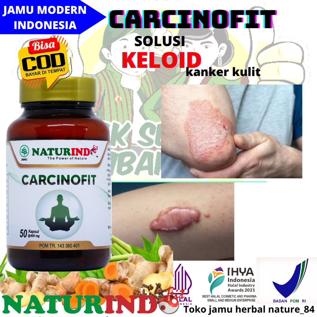 Obat Kutil Obat Keloid Obat Keloid Ampuh Obat Kutil Ampuh Obat Keloid Menahun Obat Kutil Herbal Obat