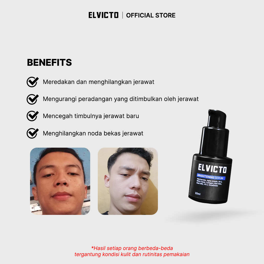 ELVICTO BRIGHTENING SERUM 20 ML