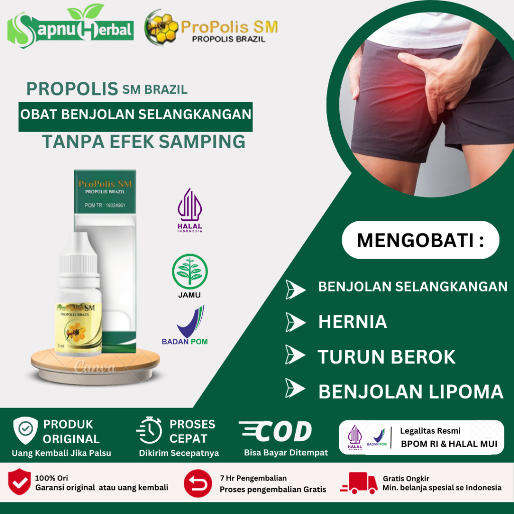 Obat Benjolan di Selangkangan, Obat Hernia, Penghilang Benjolan di Selangkangan Pria & Wanita, Obat 